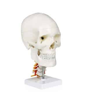 Walter Skull w/Cervical Spine