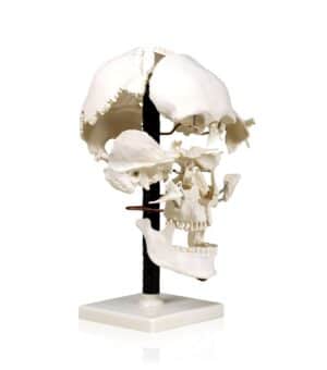 Walter Beauchene Skull