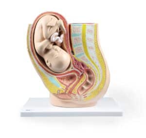 Walter Pregnancy Pelvis with Mature Fetus