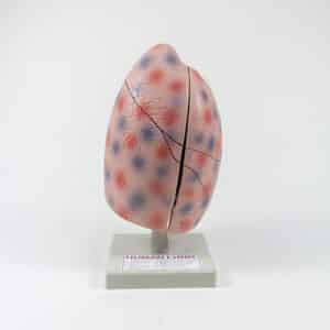 Model of the Human Lung