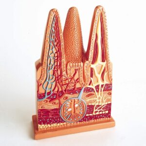 Denoyer Intestinal Villi