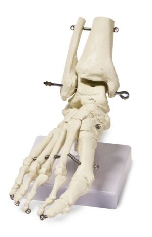 Walter Foot Skeleton