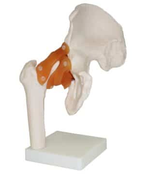 Walter Hip Joint