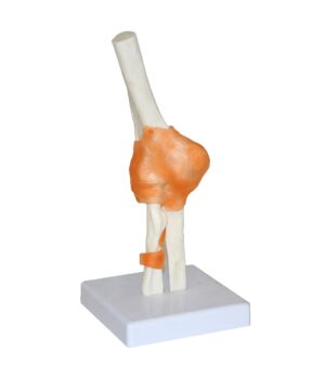 Walter Elbow Joint