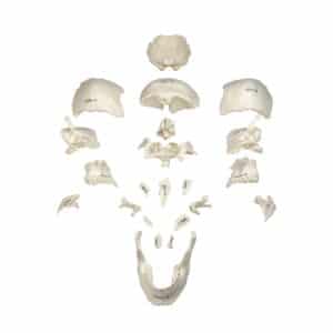 Walter Disarticulated Skull