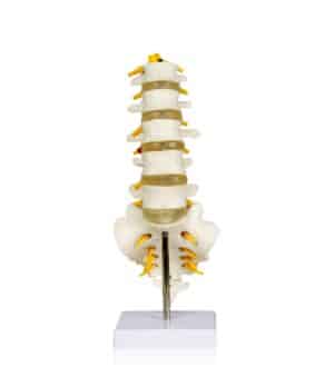 Walter Lumbar Spinal Column