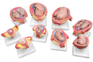 Walter Fetus Development Model