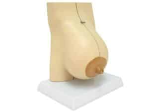 Walter Mammary Gland in Lactation