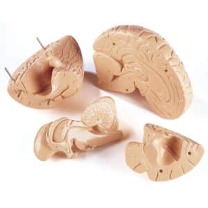 Denoyer Budget Giant Brain, 2X Life-Size - 4 Parts