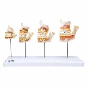 3B Dentition Development Model